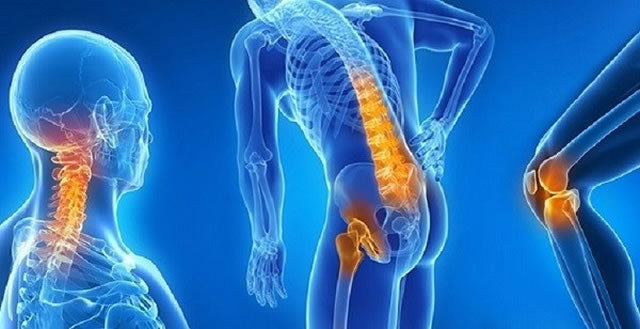 Graphic representation of a human figure with orange highlights in the areas affected by osteoarthritis, including the spine, shoulders, and knees.